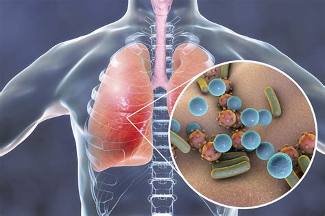 bacteria no pulmão